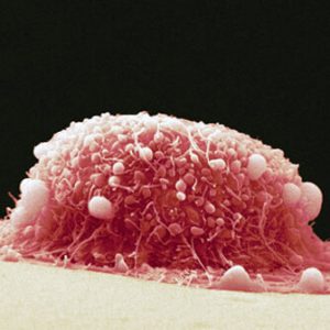 FG, PECA Unveil Medical Test To Detect 9 Cancers