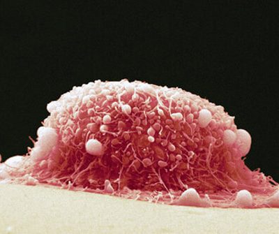 FG, PECA Unveil Medical Test To Detect 9 Cancers